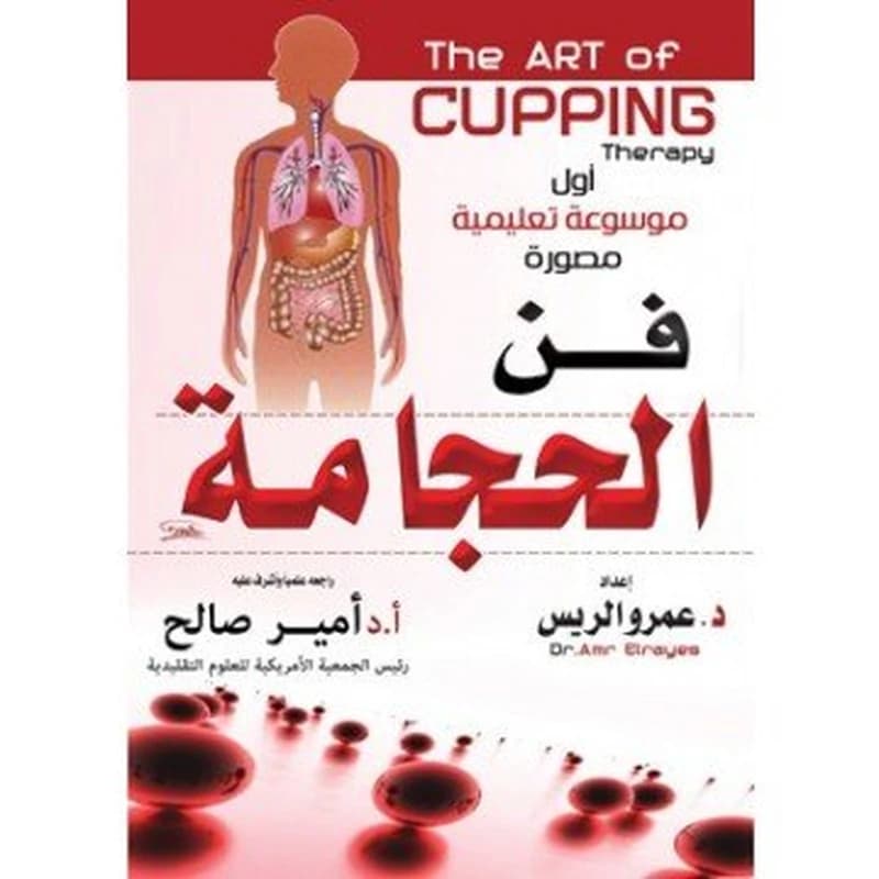 فن الحجامة
