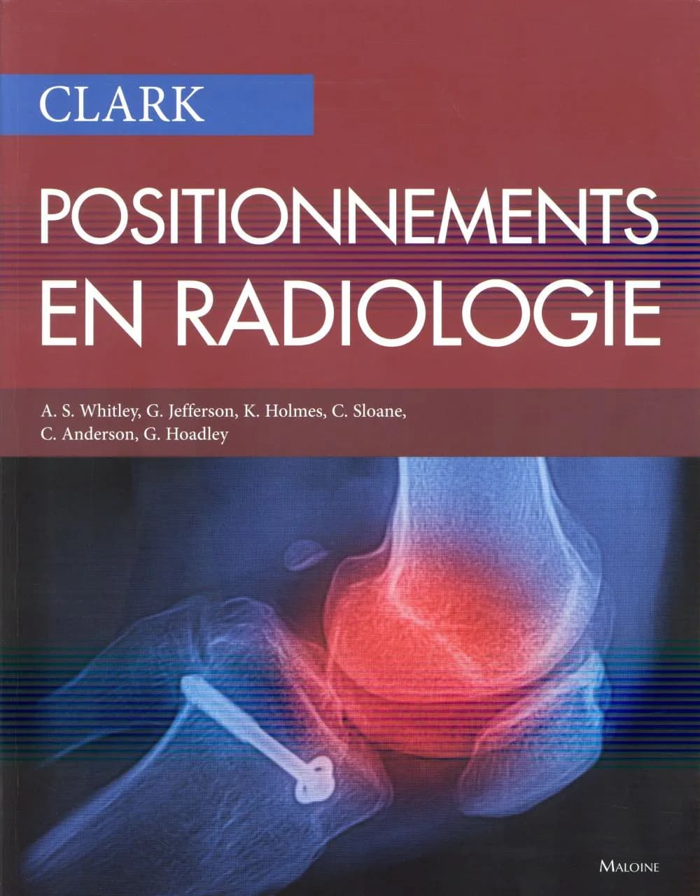 Clark, positionnements en radiologie