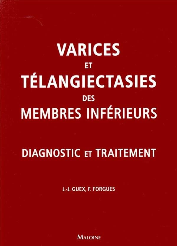 Varices et télangiectasies des membres inférieurs : diagnostic et traitement