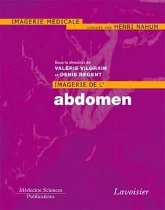 Imagerie de l'abdomen