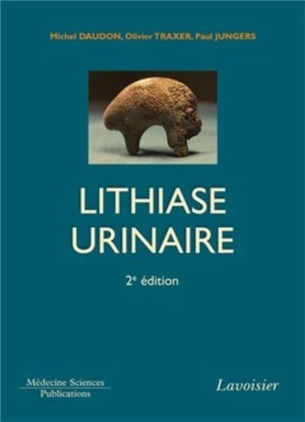 Lithiase urinaire