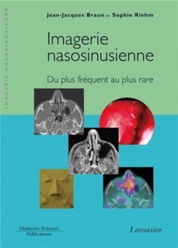 Imagerie nasosinusienne : du plus fréquent au plus rare