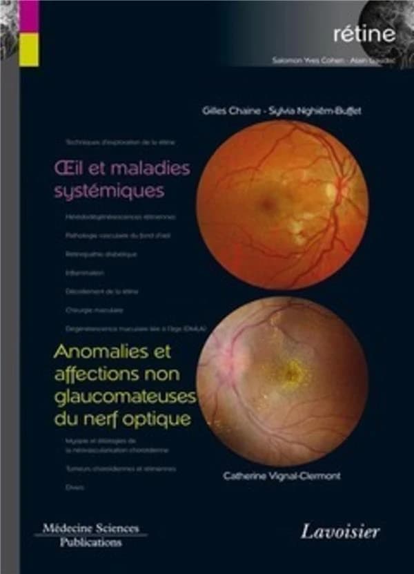 Oeil et maladies systémiques