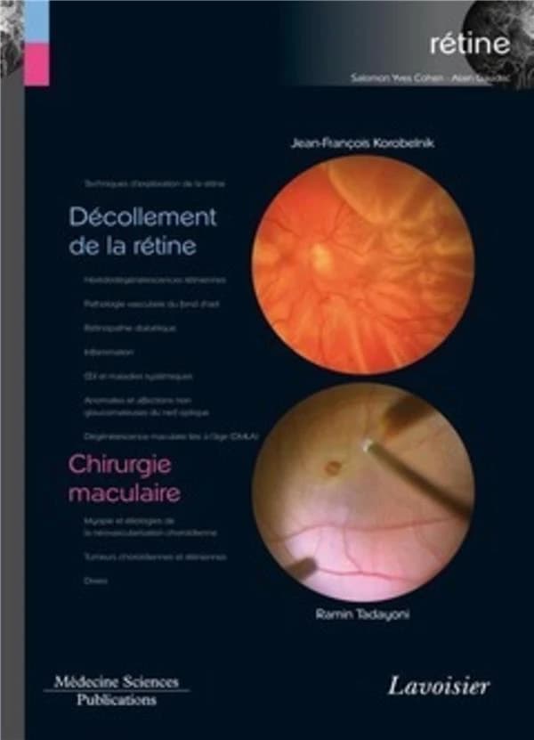 Décollement de la rétine