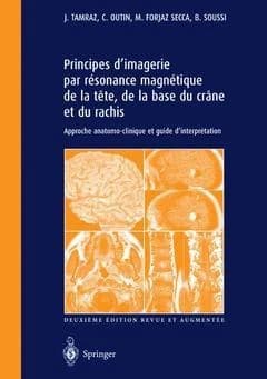 Principes d'imagerie par résonance magnétique de la tête, de la base du crâne et du rachis : approche anatomo-clinique et guide d'interprétation (2e  éd. rev.  et augm.) J. Tamraz, C. Outin, M. Forjaz Secca... [et al.]
