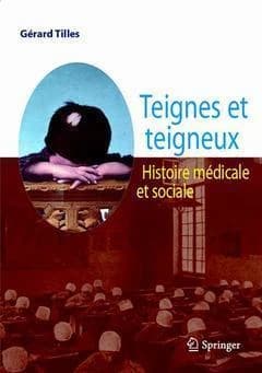 Teignes et teigneux : histoire médicale et sociale