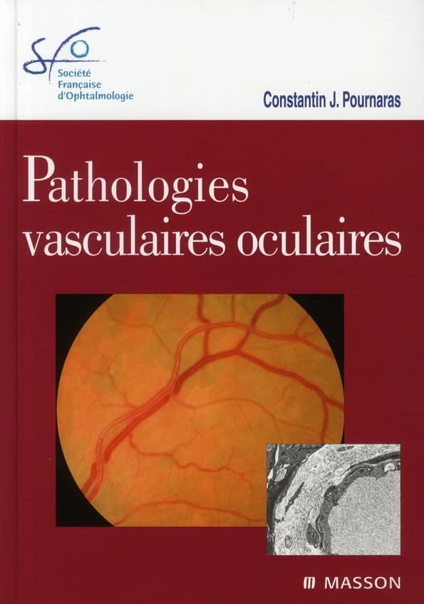 Pathologies vasculaires oculaires : [rapport présenté à la] Société française d'ophtalmologie