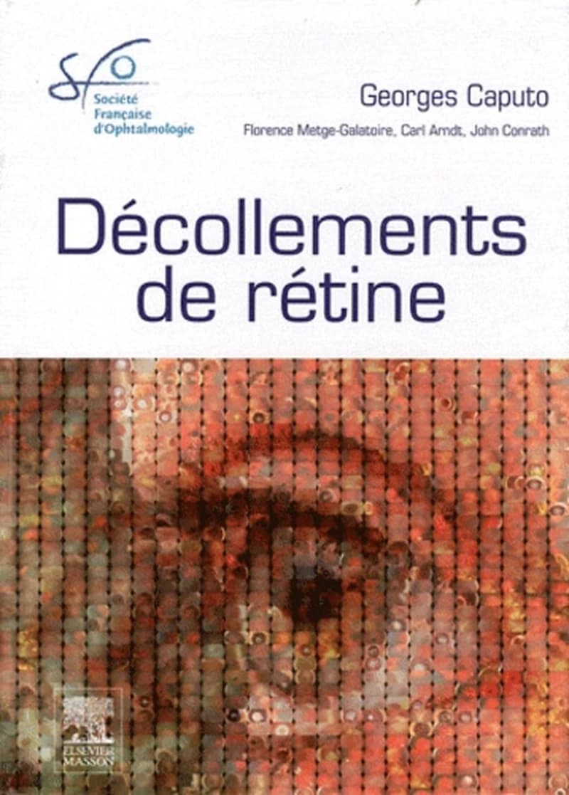 Décollements de rétine