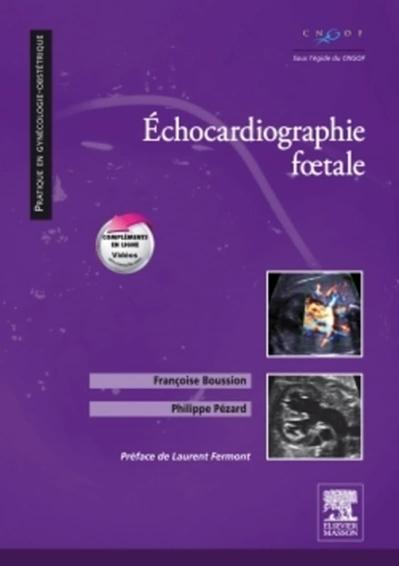 Échocardiographie foetale