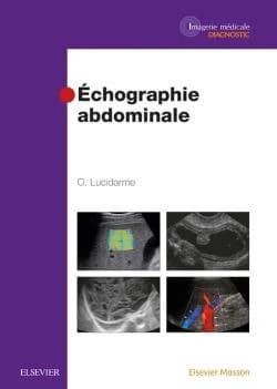 Échographie abdominale