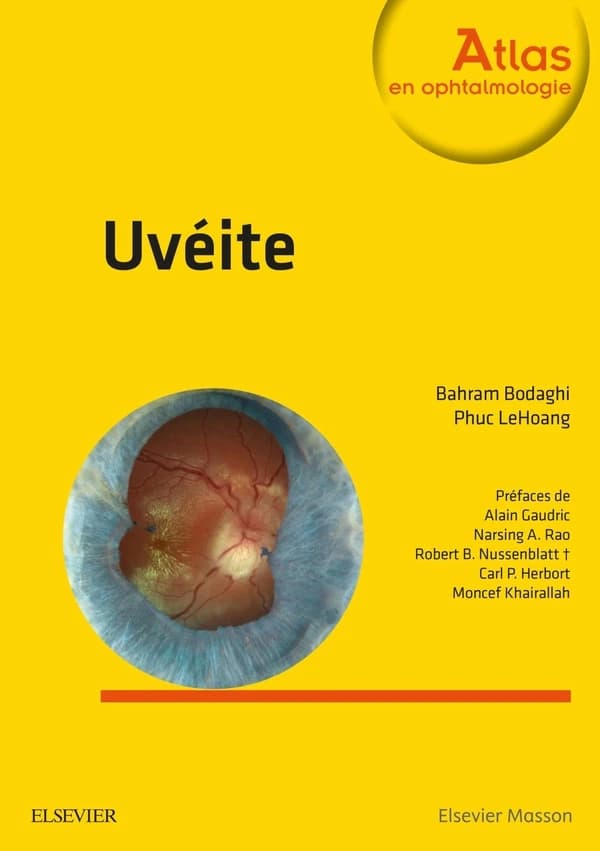 Uvéite (2e éd.) coordination, Bahram Bodaghi, Phuc LeHoang ; [auteurs, Nesrine Abroug,... Cédric Aknin,... Karine Angioi-Duprez,... et al.]