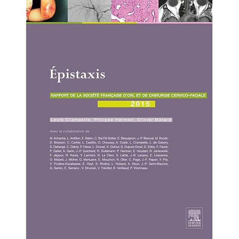 Epistaxis - Rapport 2015 de la Société française d'ORL et de chirurgie cervico-faciale