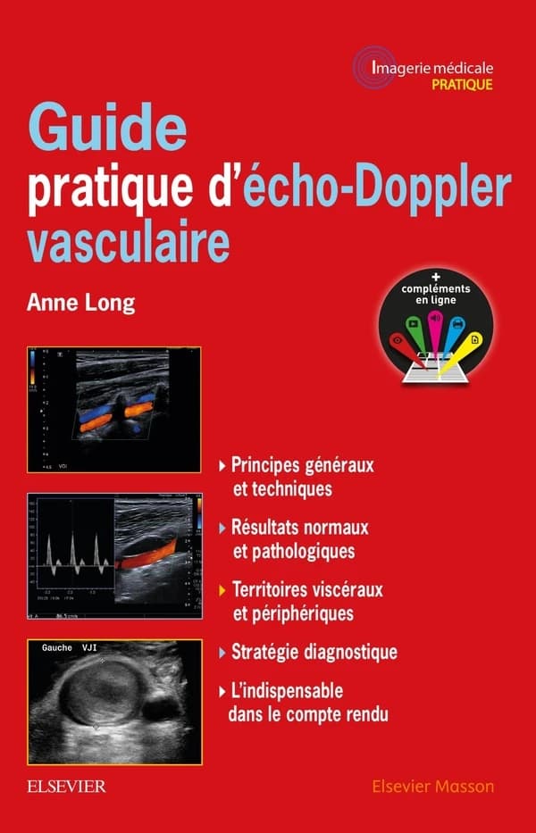 Guide pratique d'écho-doppler vasculaire