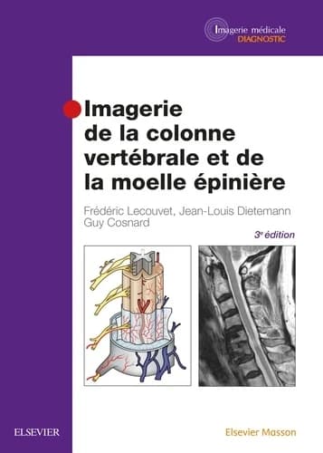 CAMPUS IMAGERIE DE LA COLONNE VERTEBRAL ET DE LA MOELLE EPINIERE