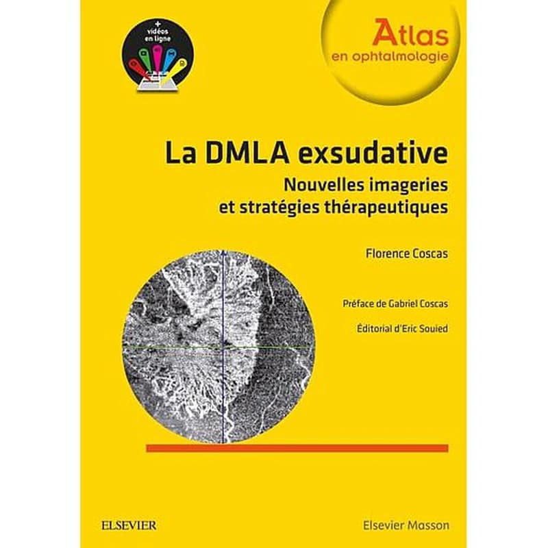 La DMLA exsudative : nouvelles imageries et stratégies thérapeutiques