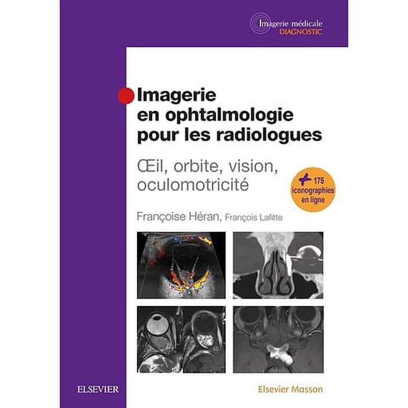 Imagerie en ophtalmologie pour les radiologues : oeil, orbite, vision, oculomotricité