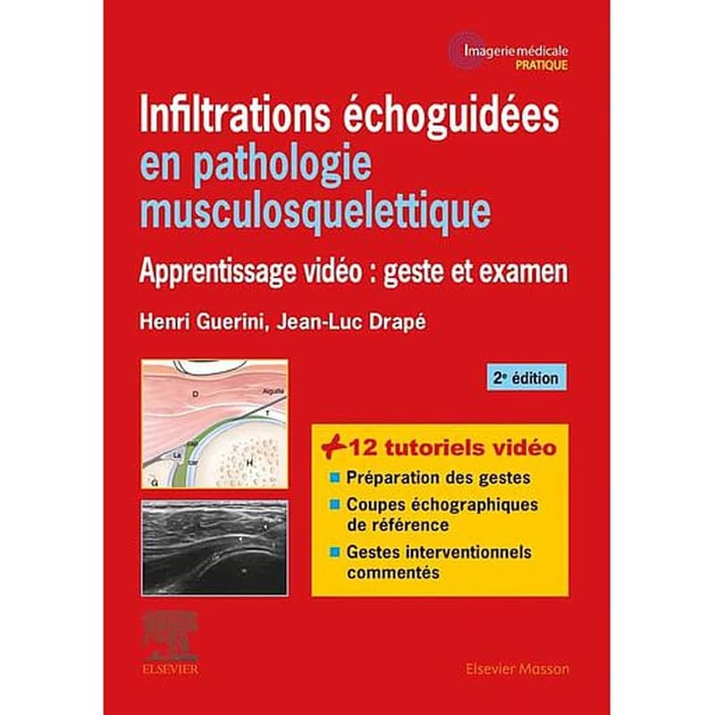 Infiltrations échoguidées en pathologie musculosquelettique : apprentissage vidéo : geste et examen (2e éd.) H. Guerini,... J.-L. Drapé,... ; dessins de A.-C. Rolling