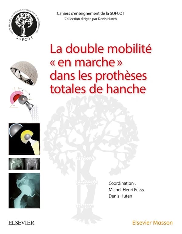 La double mobilité, en marche, dans les prothèses totales de hanche