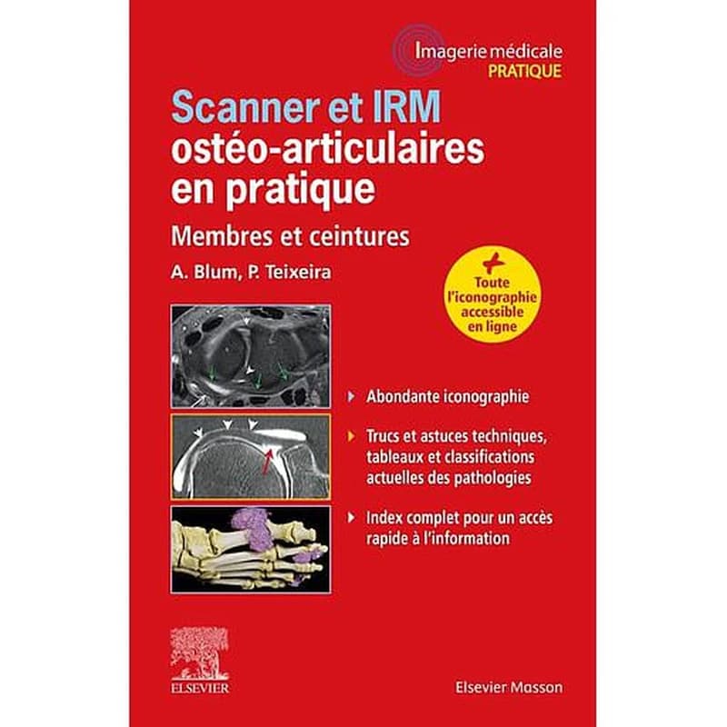 Scanner et IRM ostéo-articulaires en pratique : membres et ceintures