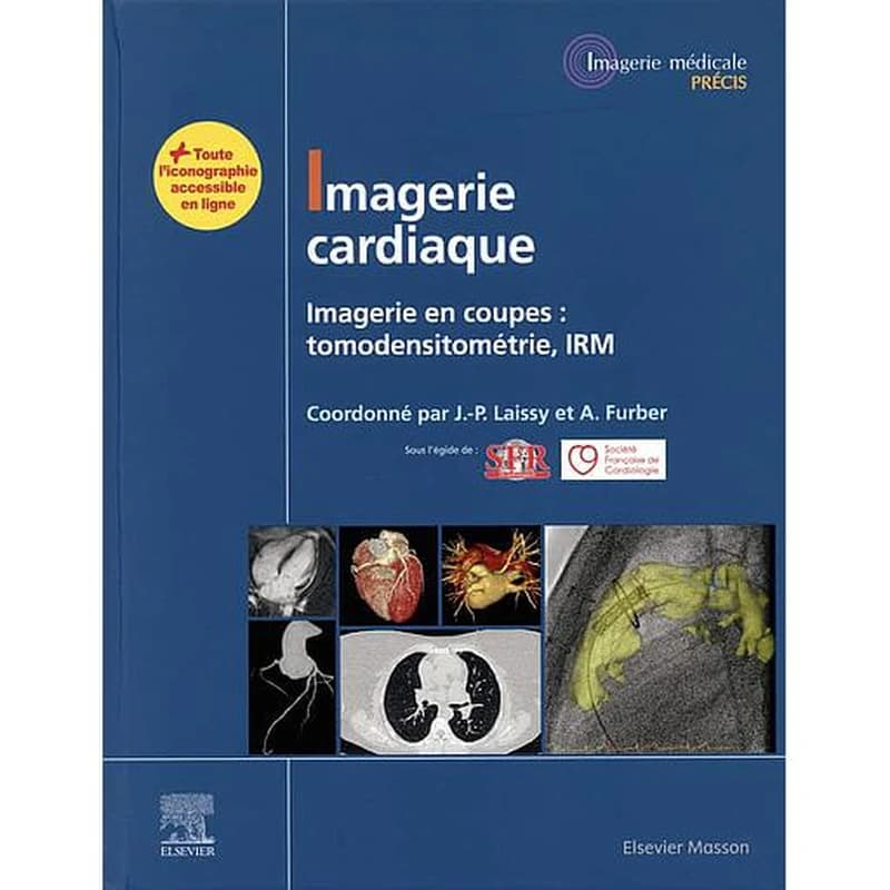 Imagerie cardiaque : imagerie en coupes : tomodensitométrie, IRM