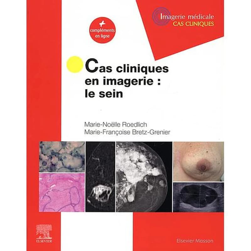 Cas cliniques en imagerie, le sein