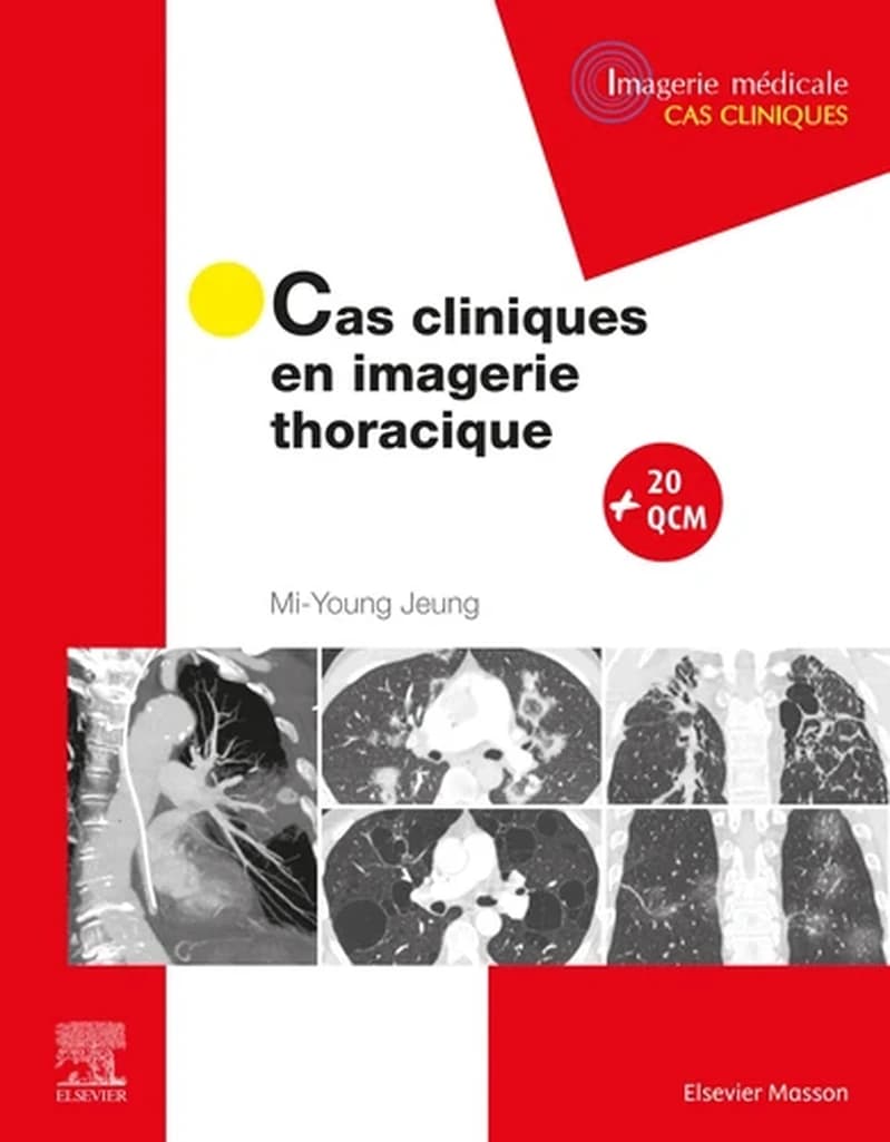 Cas cliniques en imagerie thoracique (Campus)