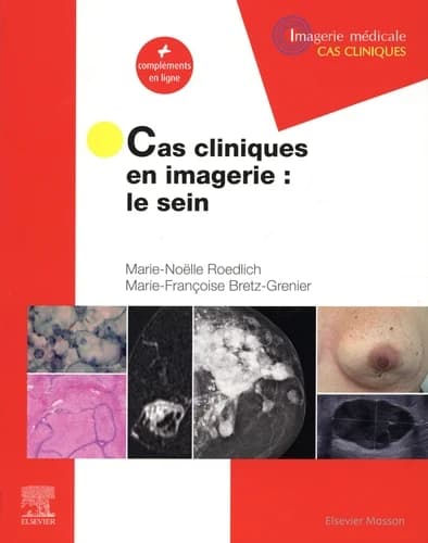 CAMPUS CAS CLINIQUES EN IMAGERIE : LE SEIN