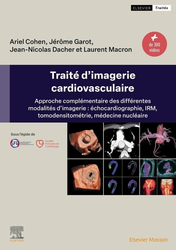 Traité d'imagerie cardiovasculaire : approche complémentaire des différentes modalités d'imagerie : échocardiographie, IRM, tomodensitométrie, médecine nucléaire