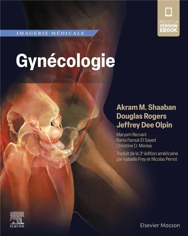 Gynécologie : imagerie médicale