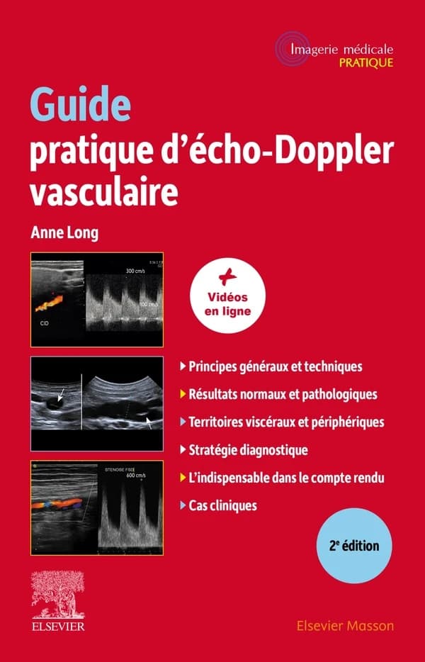 Guide pratique d'écho-Doppler vasculaire (2e éd.) sous la direction de Anne Long,...
