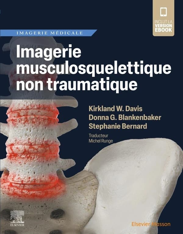 Imagerie musculosquelettique non traumatique