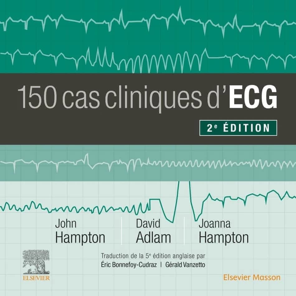 CAMPUS - 150 CAS CLINIQUES D'ECG