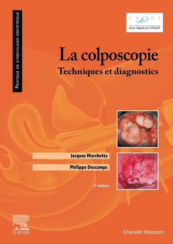La colposcopie : technique et diagnostics (5e éd.) Jacques Marchetta, Philippe Descamps ; avec la collaboration de J.-J. Baldauf, C. Bergeron, J.-P. Bilhaut... [et al.] ; sous l'égide du Collège national des gynécologues et obstétriciens français, CNGOF..