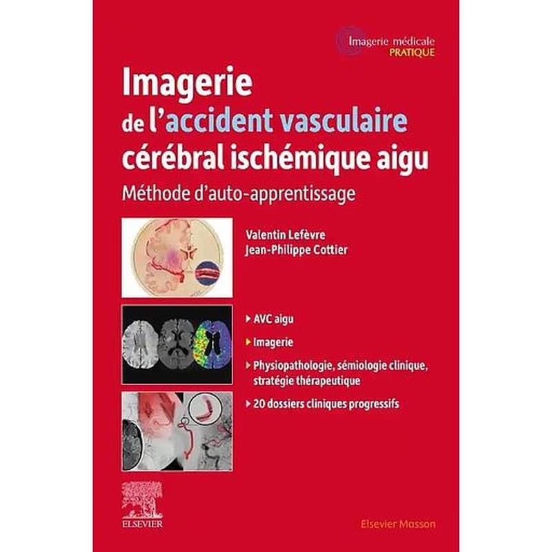 Imagerie de l'accident vasculaire cérébral ischémique aigu Edition Campus