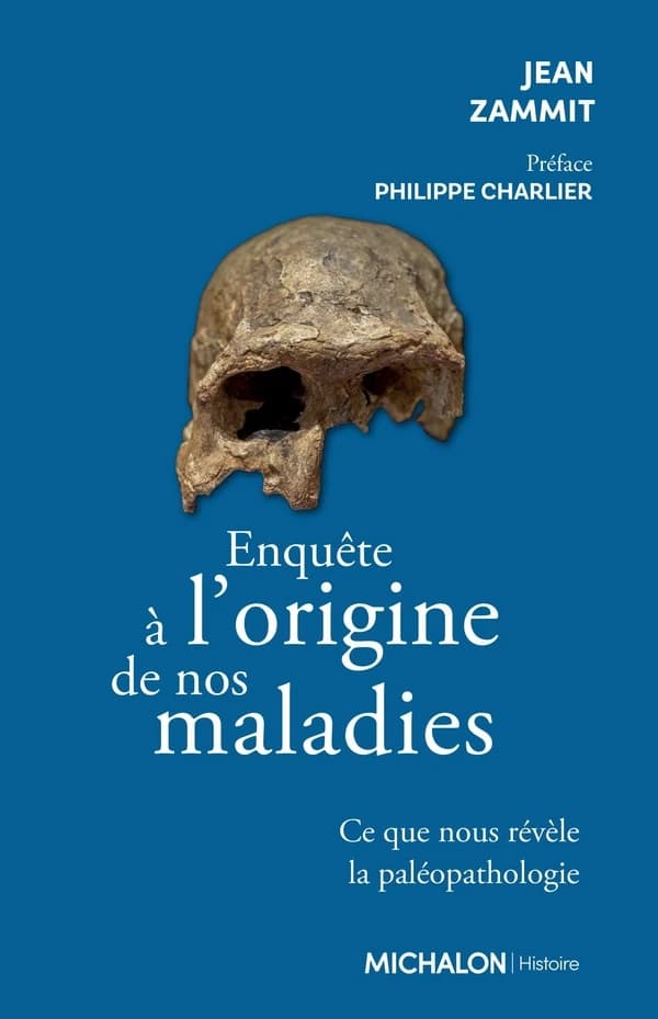 Enquête sur l'origine de nos maladies : ce que nous révèle la paléopathologie