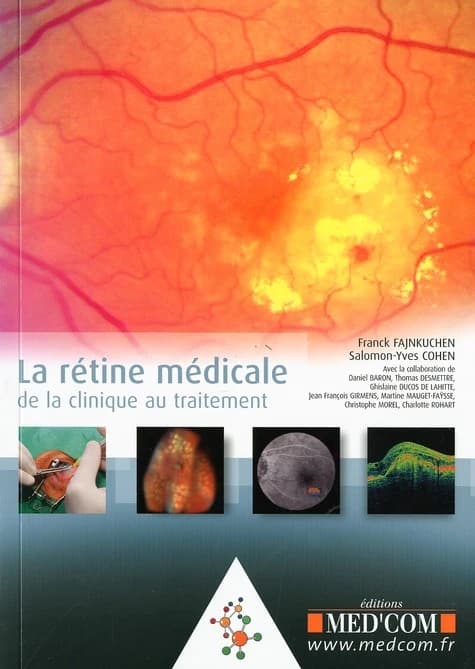 La rétine médicale : de la clinique au traitement