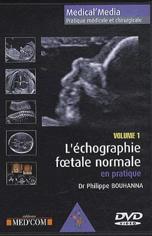 L'échographie foetale normale en pratique Tome 1
