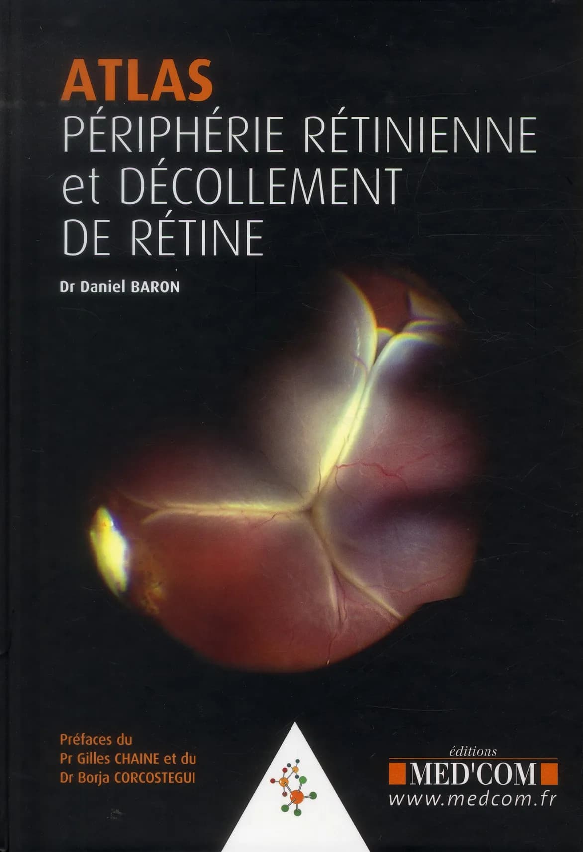 Périphérie rétinienne, décollement de rétine : atlas