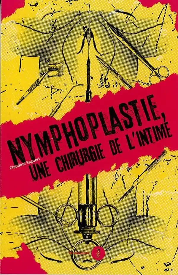 Nymphoplastie : une chirurgie de l'intime