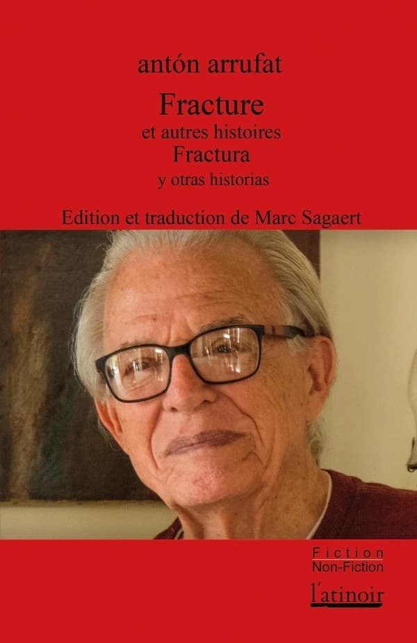Fracture : et autres histoires