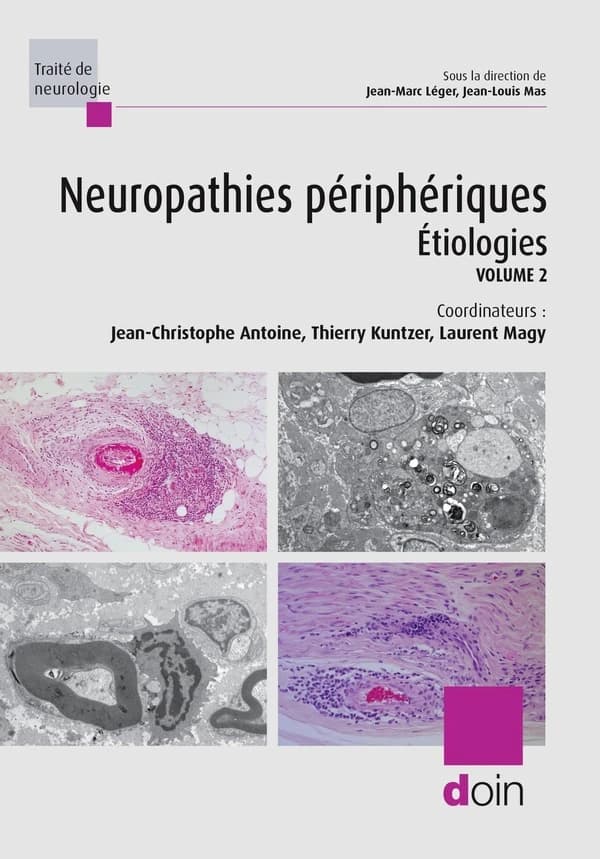 Neuropathies périphériques. Volume 2, Étiologies