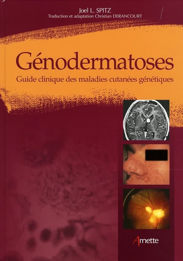 Génodermatoses : guide clinique des maladies cutanées génétiques