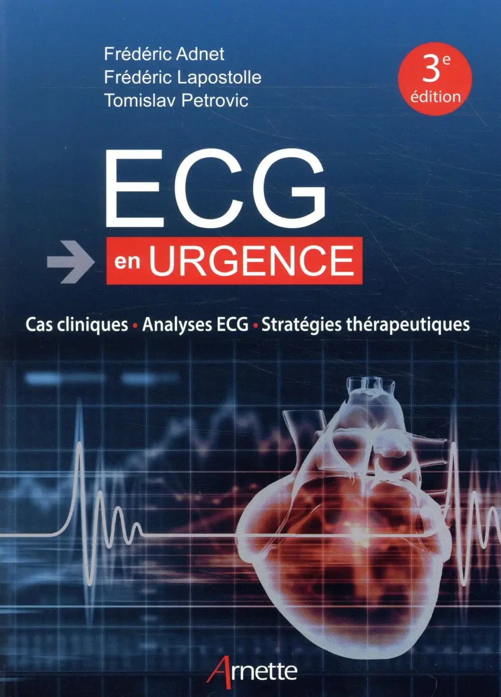 ECG en urgence : cas cliniques, analyses ECG, stratégies thérapeutiques (3e éd.) Frédéric Adnet, Frédéric Lapostolle, Tomislav Petrovic