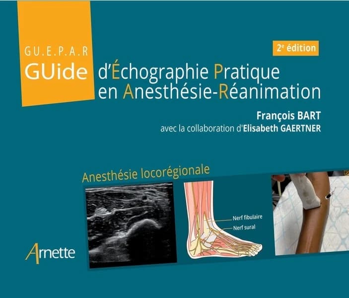 GUEPAR : guide d'échographie pratique en anesthésie-réanimation : anesthésie locorégionale (2e éd.) François Bart ; avec la collaboration d'Élisabeth Gaertner
