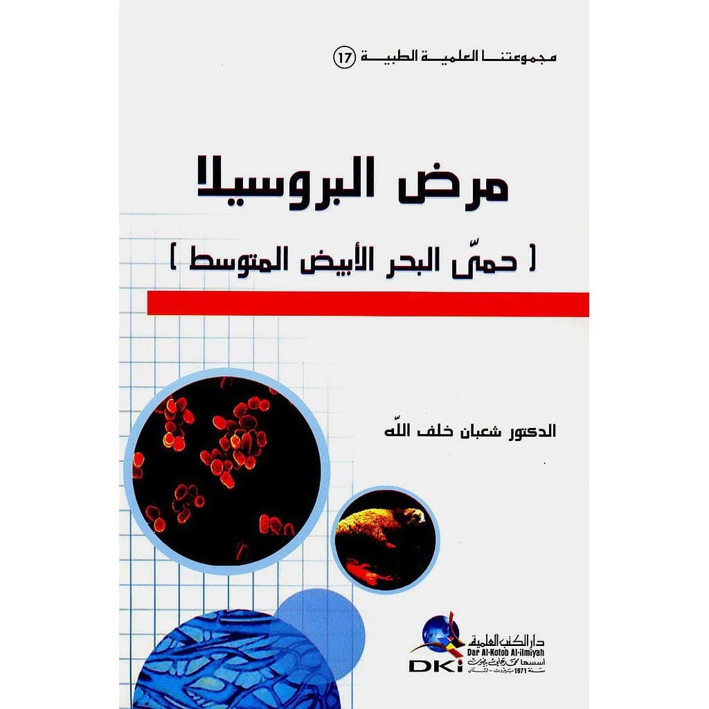 مرض البروسيلا (حمى البحر الأبيض المتوسط)