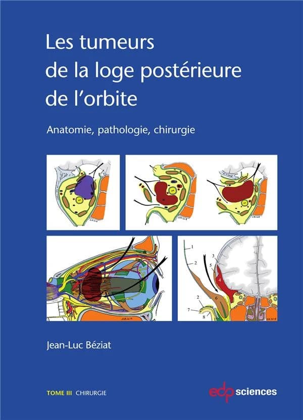 Les tumeurs de la loge postérieure de l'orbite : anatomie, pathologie, chirurgie. Tome III, Chirurgie