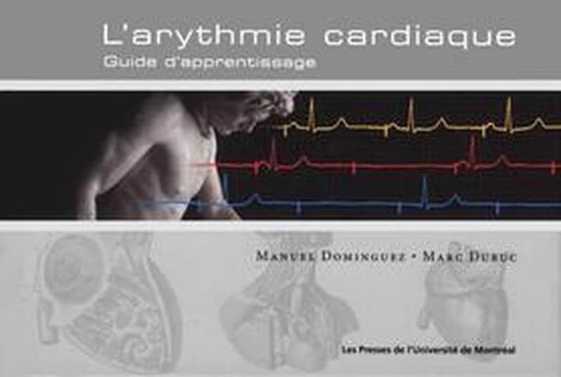 Arythmie cardiaque : guide d'apprentissage