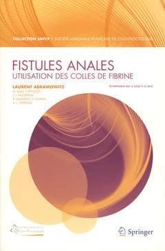 Fistules anales : utilisation des colles de fibrine