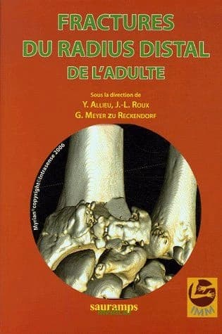 Fractures du radius distal de l'adulte