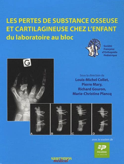 Les pertes de substance osseuse et cartilagineuse chez l'enfant : du laboratoire au bloc
